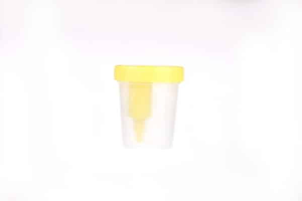 Urine Container with Needle - Image 3