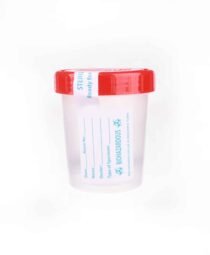 Urine Specimen Cup